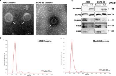 Exosomes of A549 Cells Induced Migration, Invasion, and EMT of BEAS-2B Cells Related to let-7c-5p and miR-181b-5p